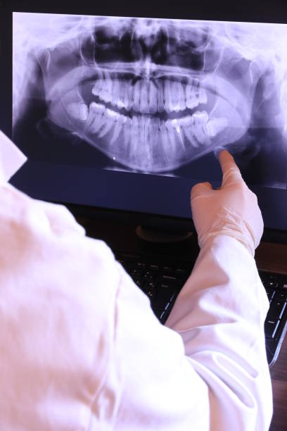 Best Knocked-Out Tooth (Avulsed Tooth) Treatment in , SD